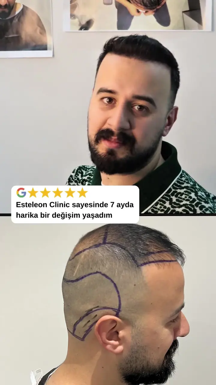 Uğur Bey sonucu